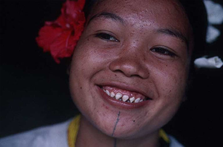 Sharp teeth of Mentawai individuals – Kalimantan